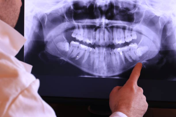 Best Knocked-Out Tooth Emergency  in Mechanicsburg, PA